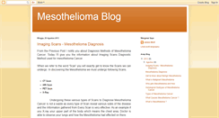 Desktop Screenshot of mesothelioma.tk